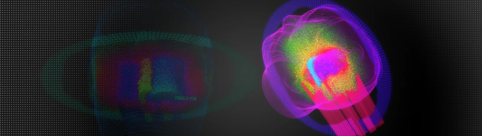 UAB Radiation Oncology treatment-planning visual
