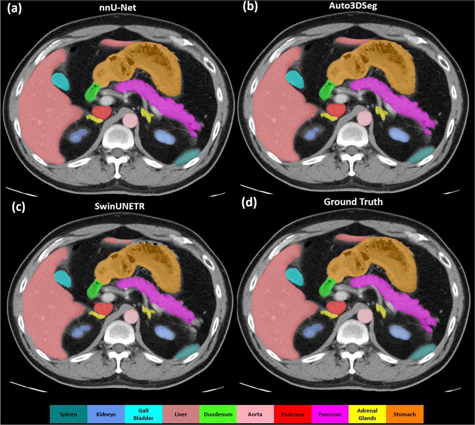 Published comparison of abdominal organ contours from nnU-Net, Auto3DSeg, SwinUNETR, and ground truth